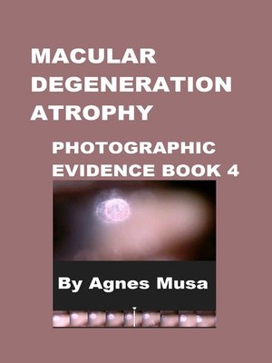 cover image of Macular Degeneration Atrophy, Photographic Evidence Book 4